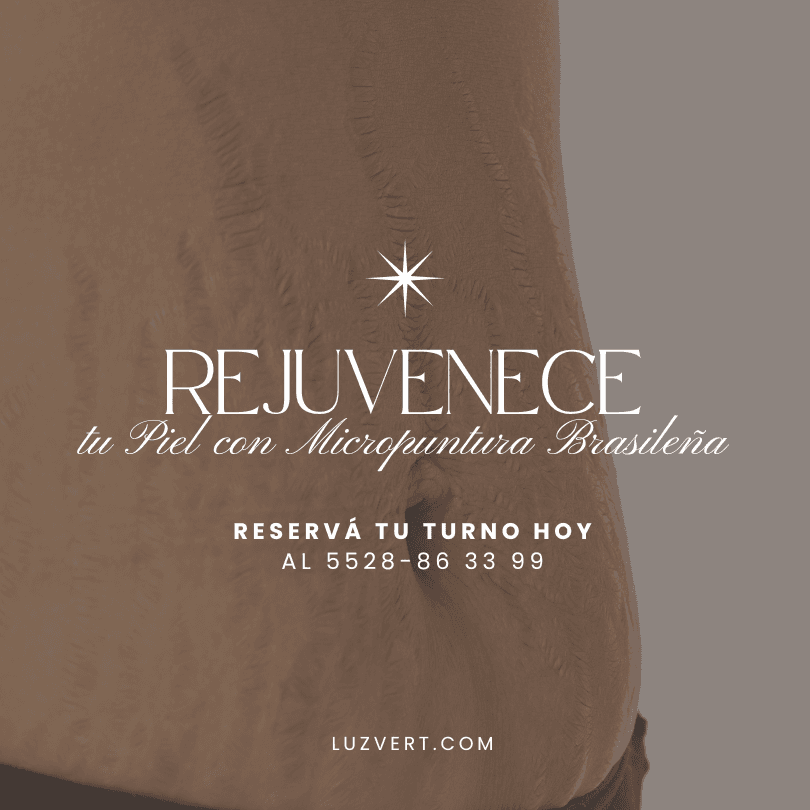 Descubre los increíbles beneficios de nuestro tratamiento para estrías. CDMX Descubre los increíbles beneficios de nuestro tratamiento para estrías. CDMX