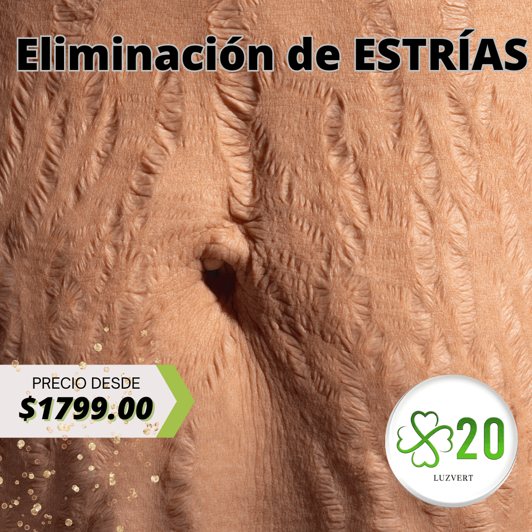 Regeneración de estrías en CDMX Regeneración de estrías en CDMX